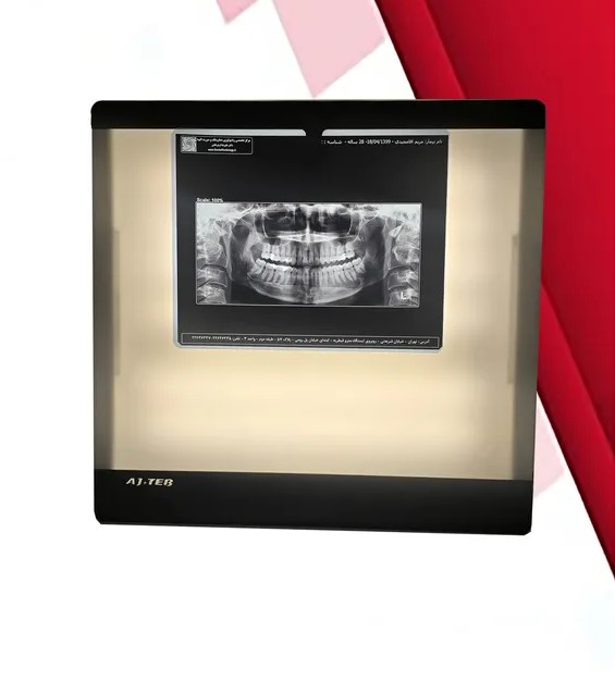 نگاتوسکوپ اتوماتیک AjTeb مدل CTX-PG-AT